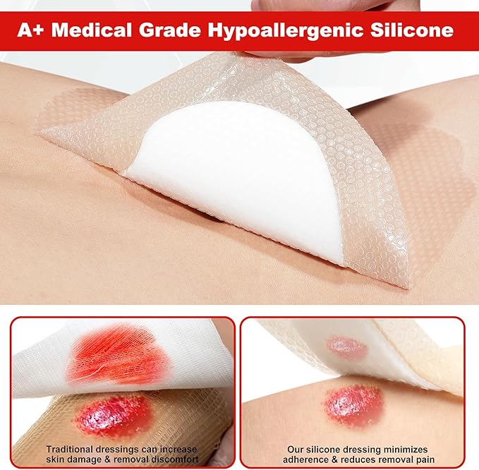 7"x7" (Pack of 10) Wound Silicone Sacral Foam Dressing Sacrum Foam Adhesive with Border - Waterproof Absorbent Breathable Bed Sore Pressure Pads